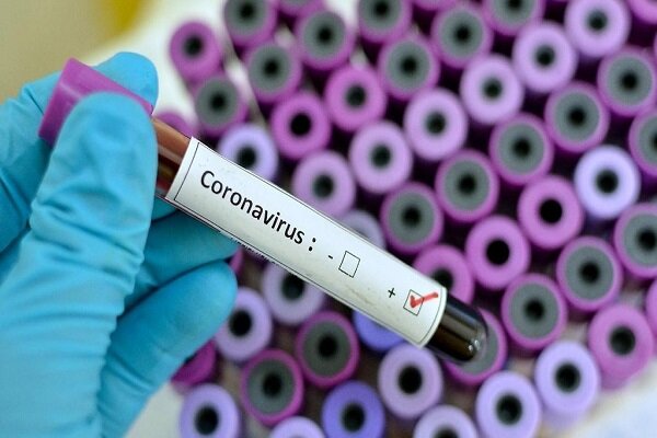 آزمایش های تشخیص ویروس کرونا